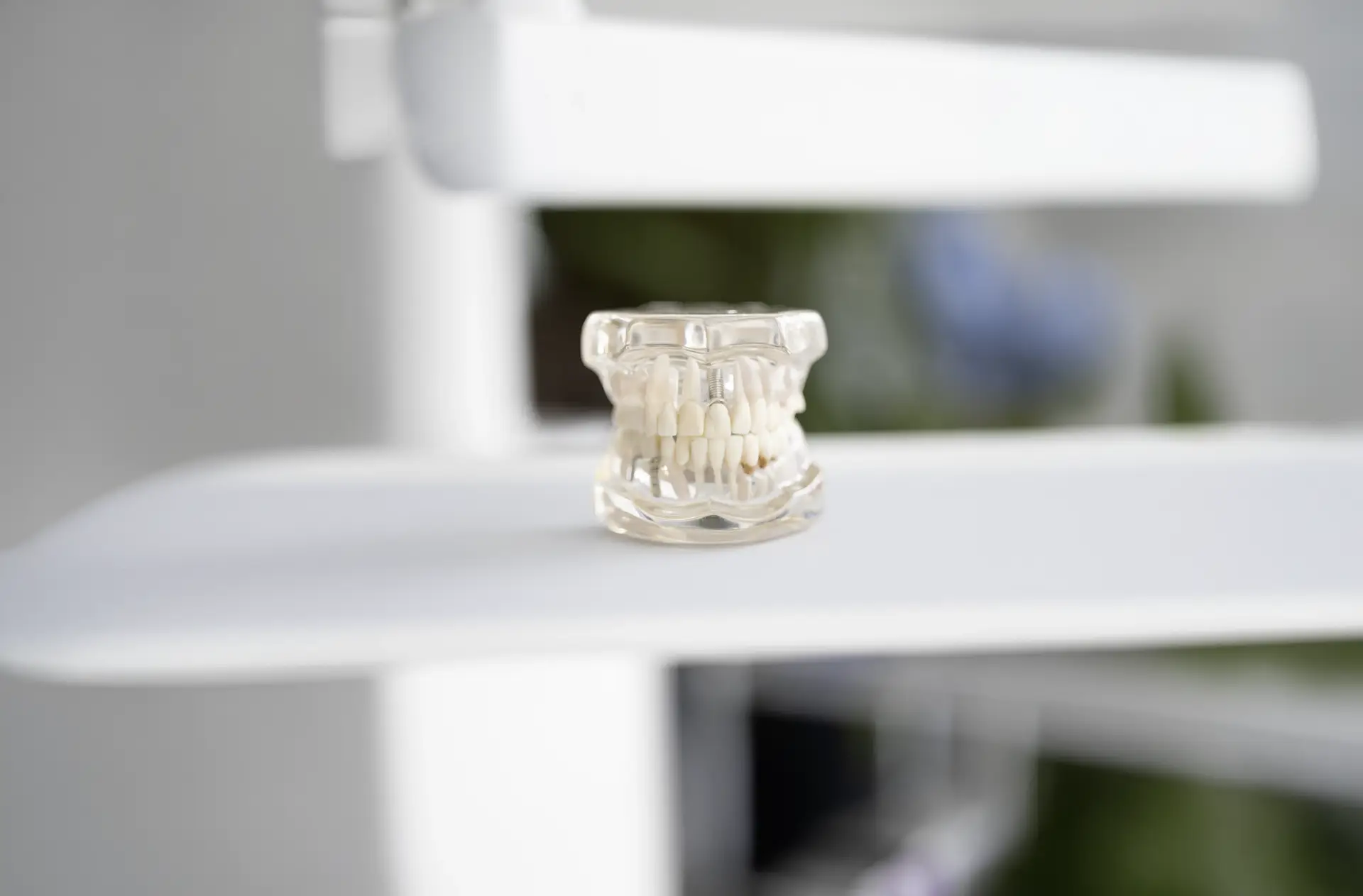 Parodontitis vs Gingivitis: Razlike, simptomi i metode liječenja